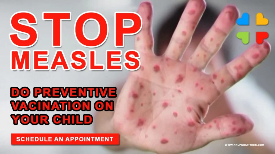 Stop Measles with North Florida Pediatrics PA Measles Preventive Vaccination 2025